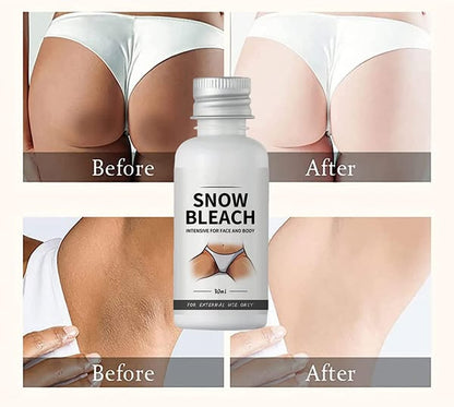 Dark Spot Remover Cream